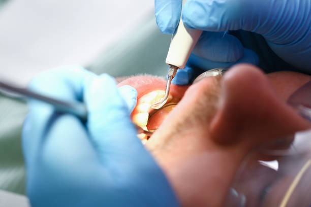 Best Emergency Treatment for Dental Infections or Abscesses in Mcgregor, TX