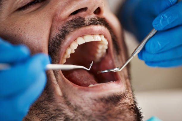 Best Emergency Gum Treatment in Mcgregor, TX